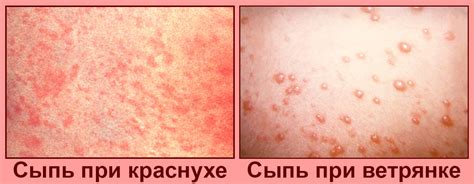 Аллергические реакции и другие кожные проблемы, вызывающие сыпь при нормальной температуре