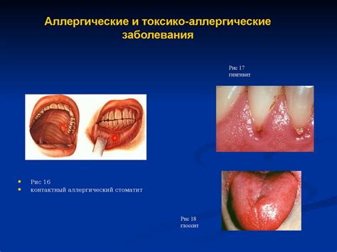 Быстрое и мощное раздражение слизистой оболочки