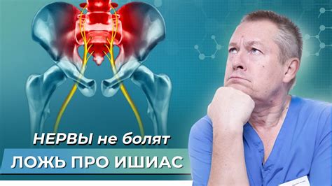 Вариативные приемы для исправления смещения седалищного нерва в медицине