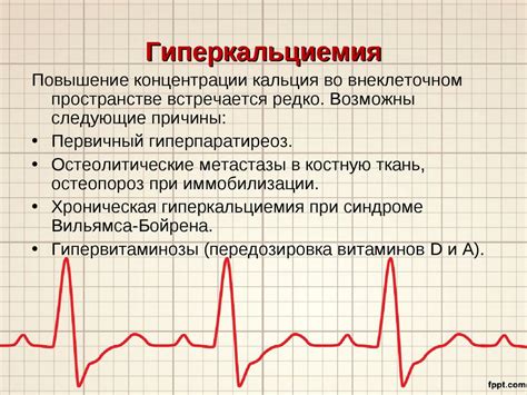 Влияние нарушения электролитного баланса на появление Эос полувертикальной на ЭКГ: