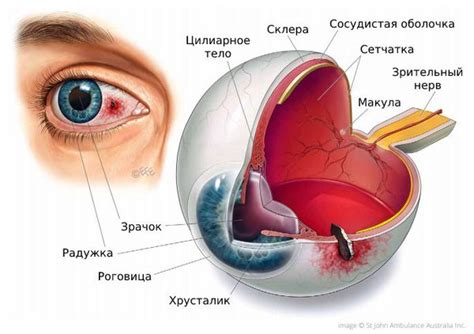 Влияние травм глаз на здоровье и слезление у фелинов