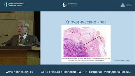 Влияющие на эффективность препарата после релизации яйцеклетки факторы