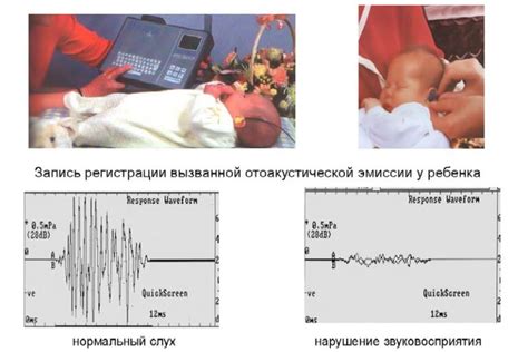 Возможные факторы, вызывающие возникновение регургитации у грудничка