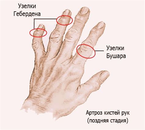 Вредность или безопасность треска в суставах