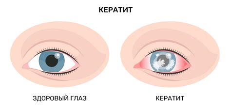 Выявление глазных проблем у домашних питомцев