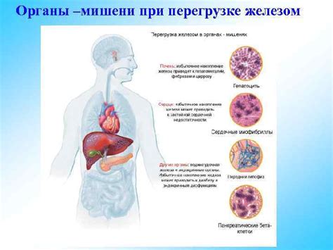 Диагностика нарушений содержания железа в организме: основные методы и признаки