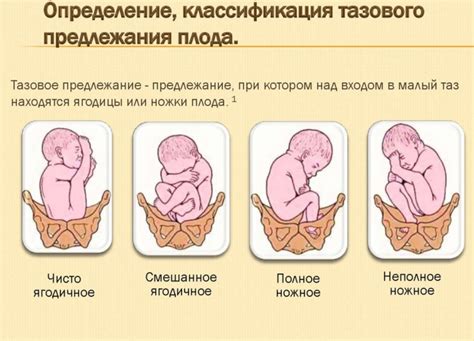 Значение для будущего малыша: продольное предлежание головное