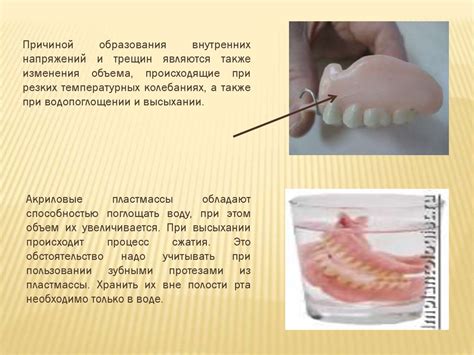 Изготовление индивидуальных протезов: принципы работы стоматологической лаборатории