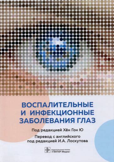 Инфекционные заболевания глаз: признаки и диагноз