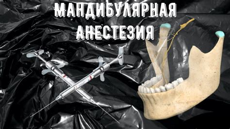 История возникновения терминов "анастезия" и "анестезия"