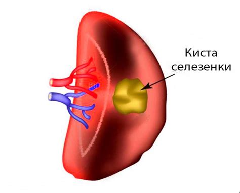 Мигрень и беременность: потенциальные риски и рекомендации