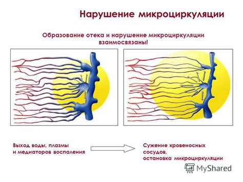 Нарушение микроциркуляции век