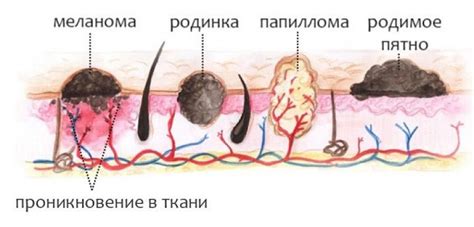 Негативные последствия травмирования родинки до появления крови