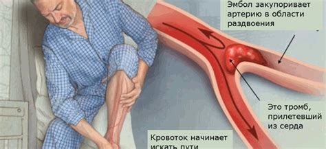 Негативные последствия эмболии в различных органах