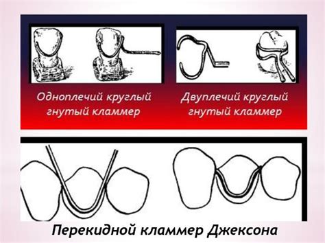 Негативные стороны применения весов в расположении элементов