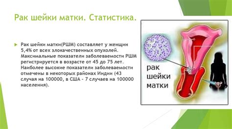 Неравномерное размягчение шейки матки