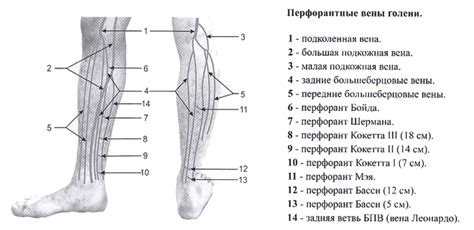 Несостоятельные перфорантные вены: что это и как они возникают