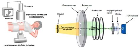 Обследование с использованием рентгеновского исследования