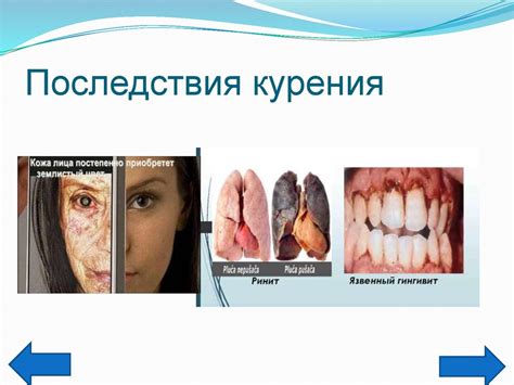 Опасность душка: пиростепеноз, заболевания и их последствия