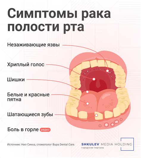 Основные признаки анемии, на которые важно обратить внимание