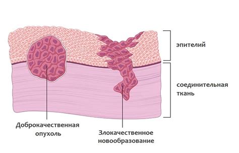 Основные признаки и влияние опухоли на ноге