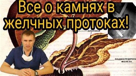 Основные признаки наличия кальцинатов в печени и желчных протоках