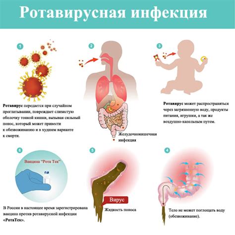 Основные проявления и причины возникновения симптомов ротовирусной инфекции у малышей
