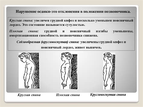 Особенности осанки и типов телосложения