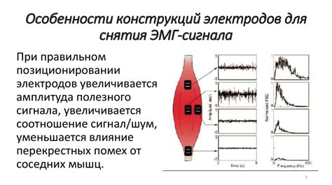 Особенности снятия электродов