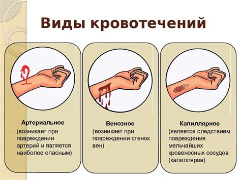 Остановка кровотечения и профилактика инфекции