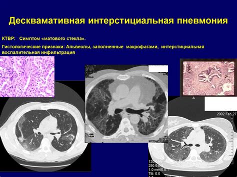 Патологические изменения в легких, вызывающие гипоксию