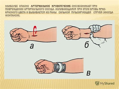 Первая помощь при повреждении градусного стекла