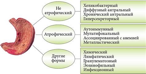 Повреждение слизистой оболочки желудка