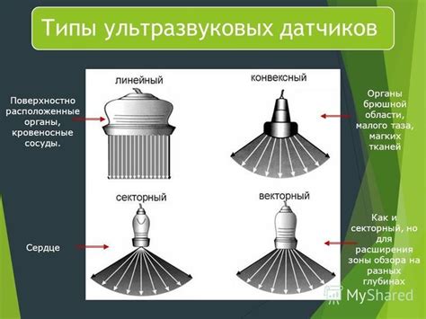 Подбор оптимальной комбинации настроек для расширения зоны обзора