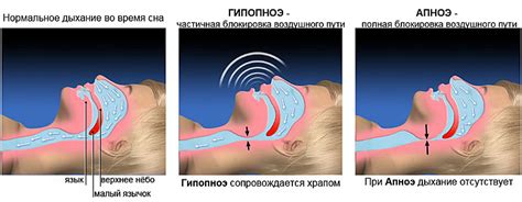 Последствия неправильного дыхания во сне