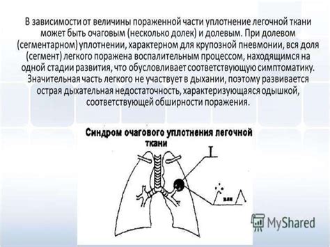 Последствия неравномерной пневматизации легочной ткани