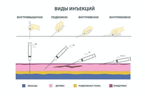 Послезабота о месте инъекции: важные рекомендации