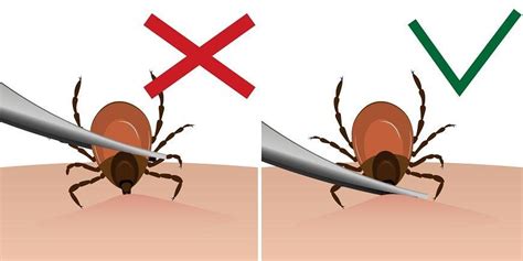 Почему выбор способа удаления клеща с использованием нитки – надежное решение