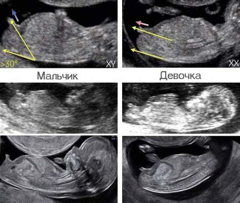 Предварительные признаки пола малыша и его будущего внешнего вида