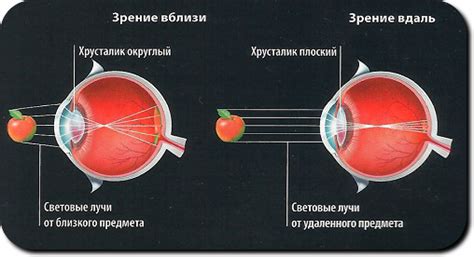 Причины недостаточной фокусировки глаз