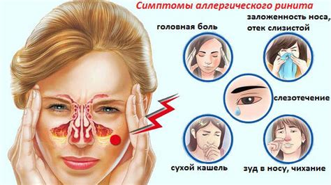 Проблема заложенности носа: причины и последствия