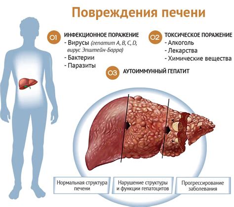 Проблемы заболевания