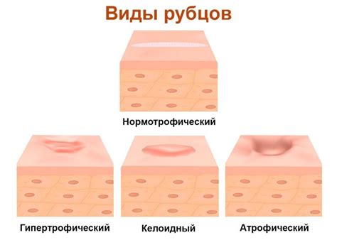 Профилактика и предупреждение рубцов от порезов вен