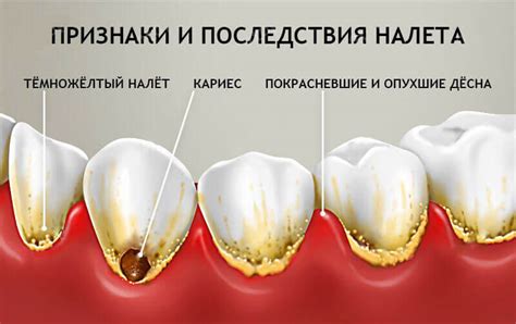 Распыление воды: как устройство неупереваемо убирает зубной налёт и остатки пищи