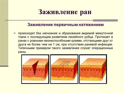 Роль швов в процессе заживления раны: из чего они состоят и зачем их наносят