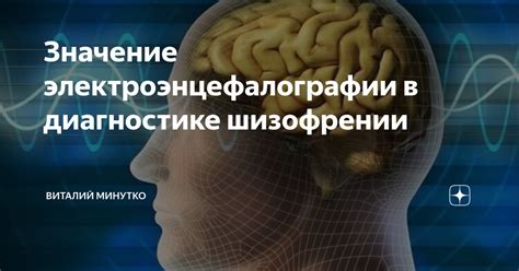 Роль электроэнцефалографии в диагностике черепно-мозговых травм