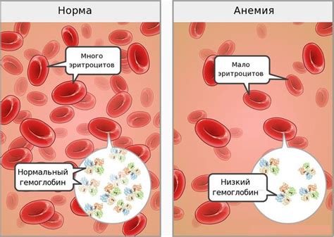 Симптоматика при избытке железа