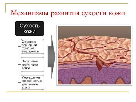 Сухость кожи и нарушение ее защитной функции