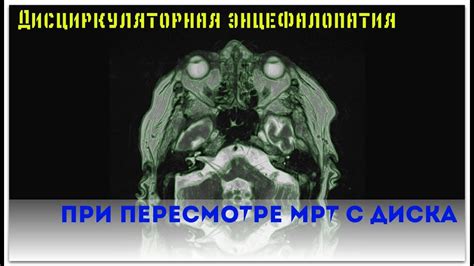 Точность результатов МРТ