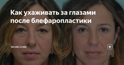 Уход за глазами после сеанса работы с электронными устройствами